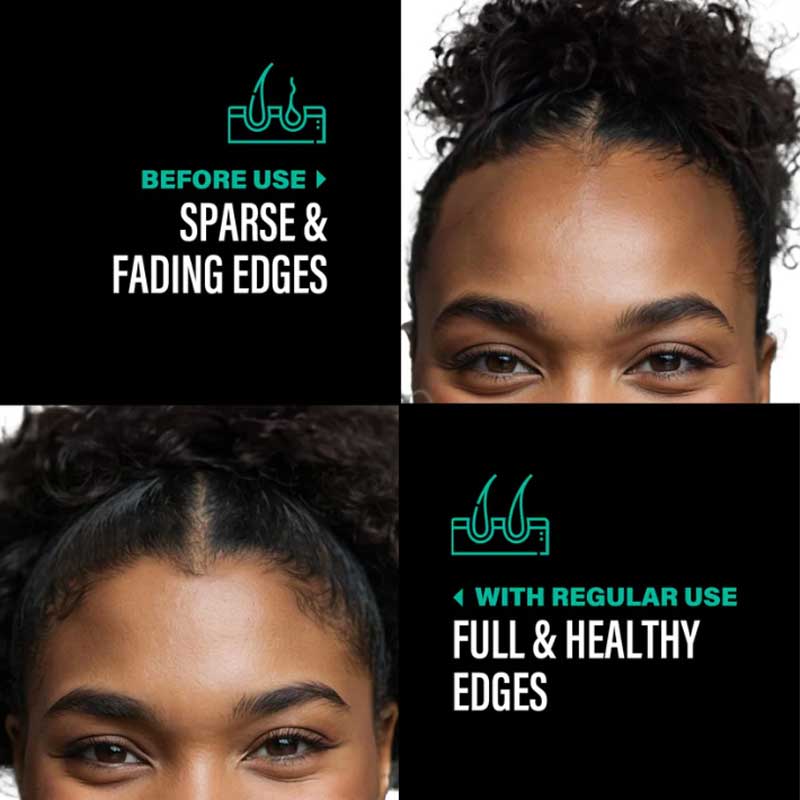 Batana Natural Hair Growth Oil