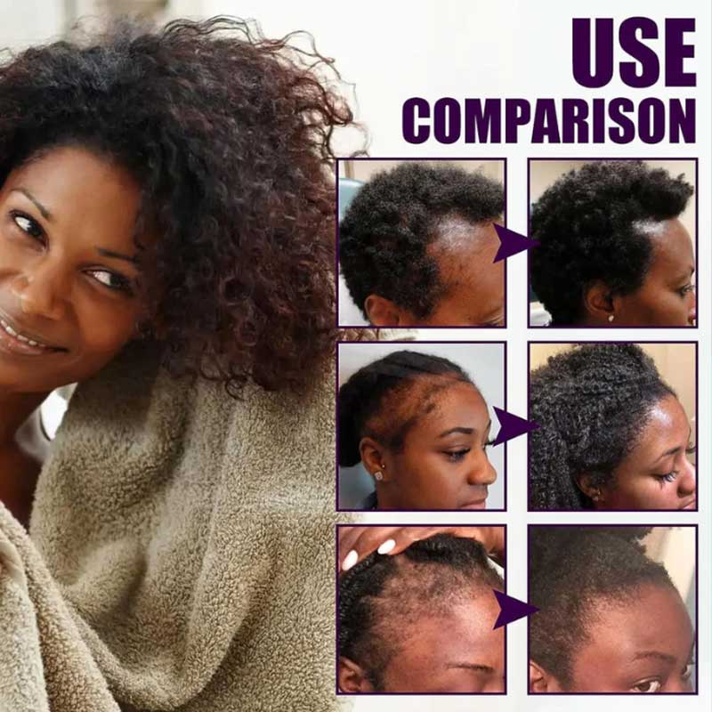 Batana Natural Hair Growth Oil