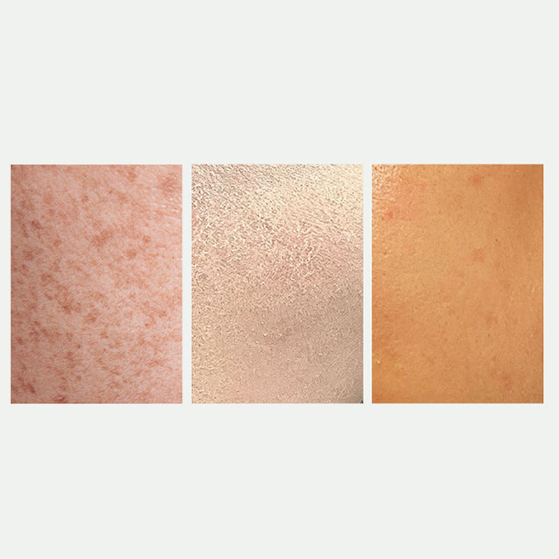 Radiant Skin Whitening & Spot Correcting Spray